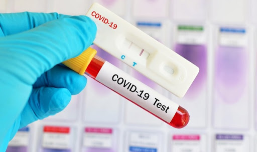 PROJETO INCLUI OFICIAIS DE JUSTIÇA ENTRE PROFISSIONAIS COM PRIORIDADE PARA TESTES DA COVID-19